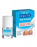 Post Mycosis My Nails 5ml